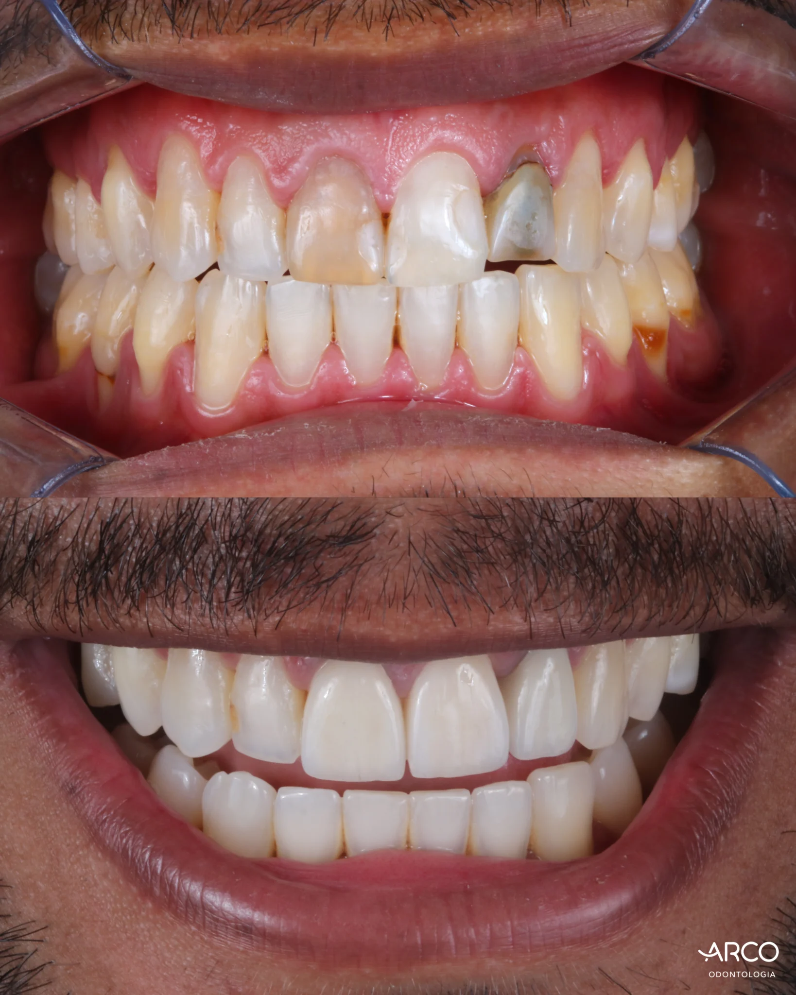 arco-odontologia-caso1