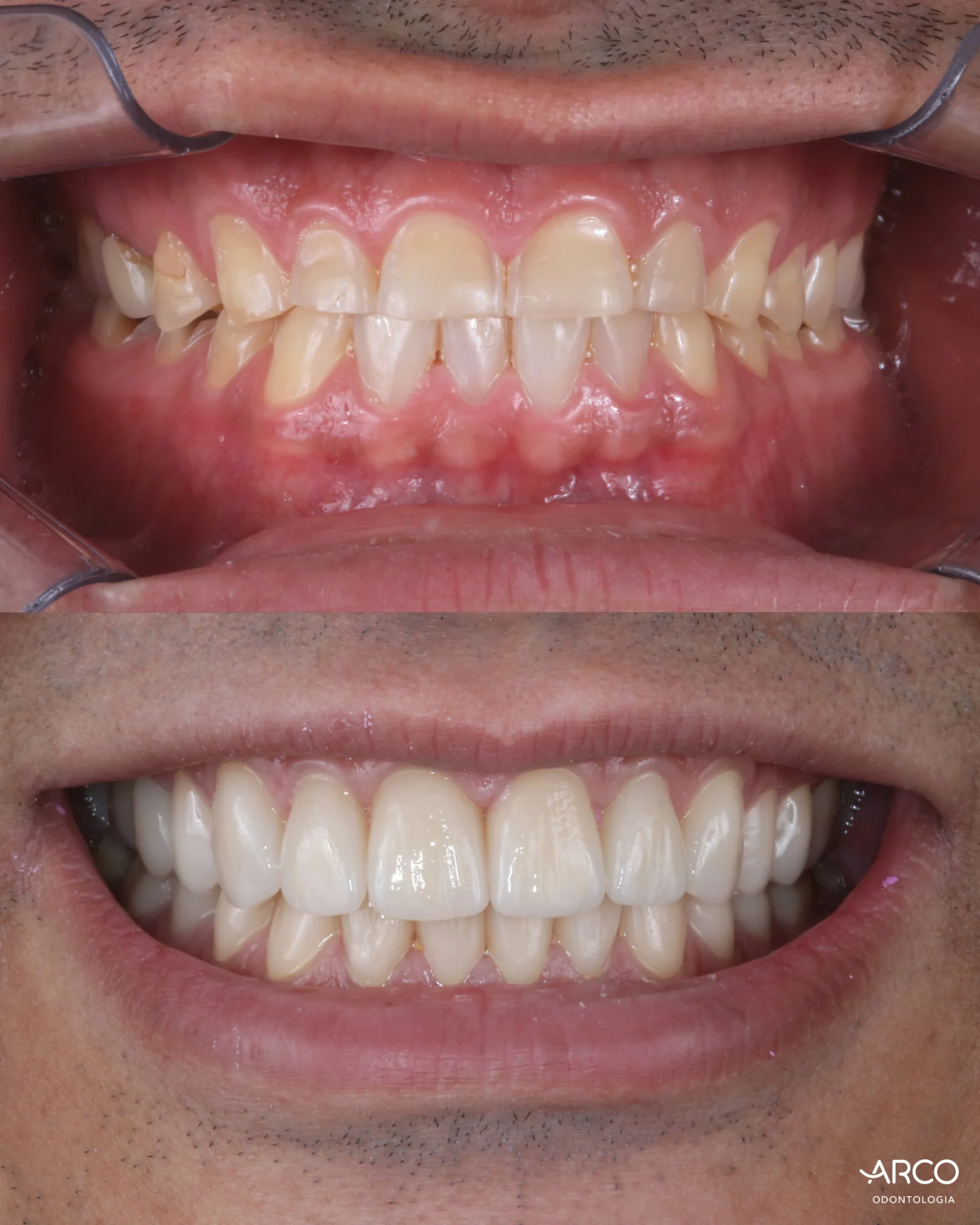 arco-odontologia-caso2