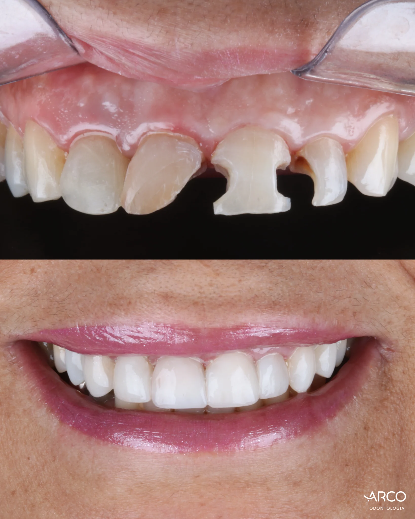 arco-odontologia-caso3