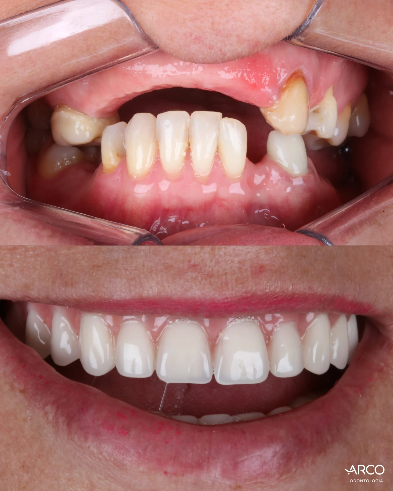 arco-odontologia-caso4