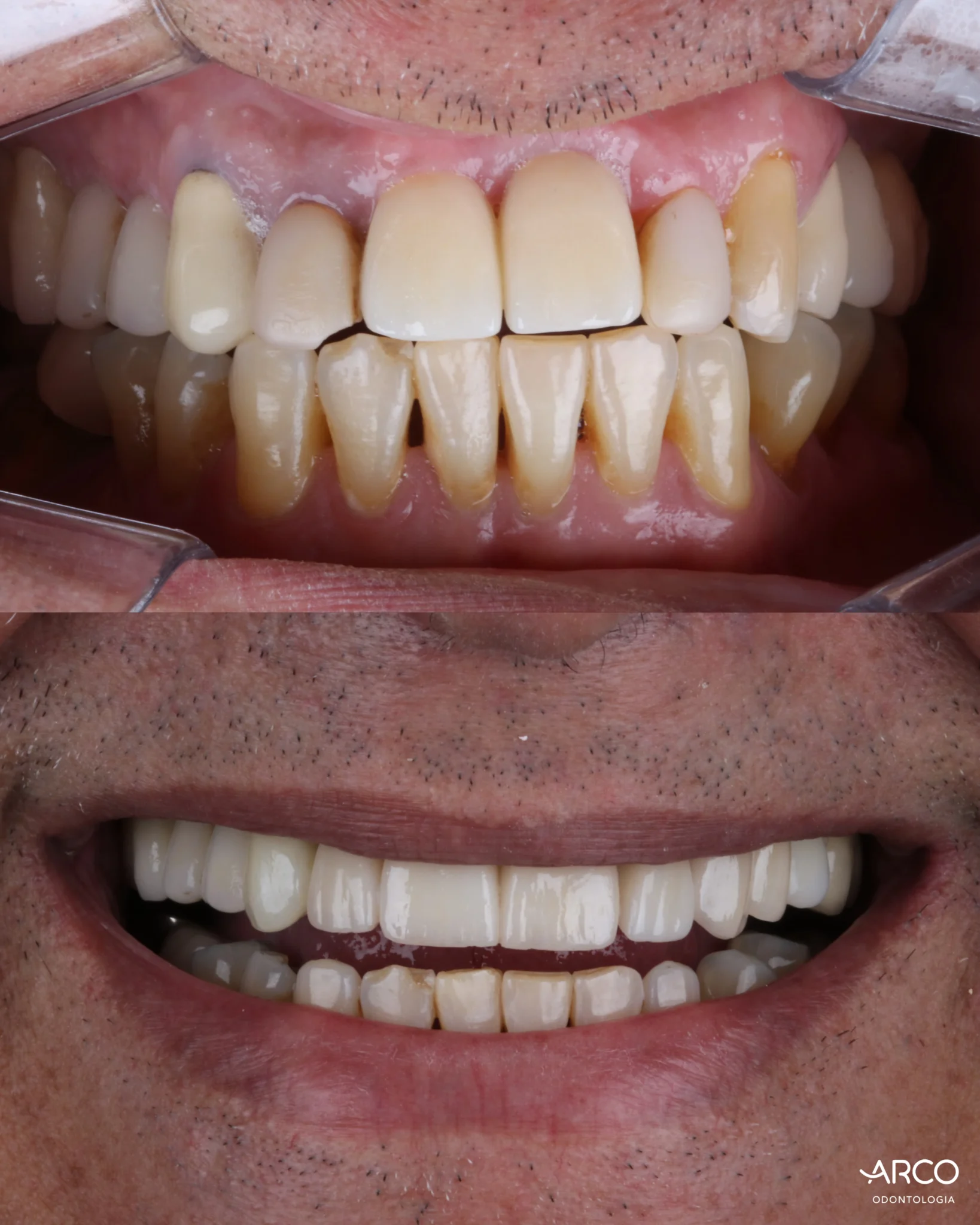 arco-odontologia-caso5